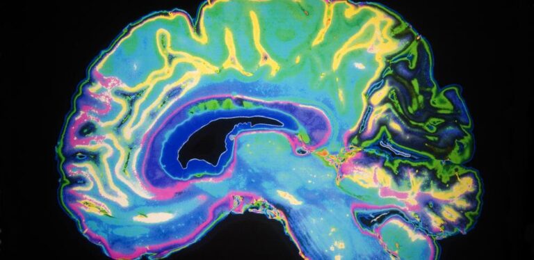 Brain MRIscan1 768x374