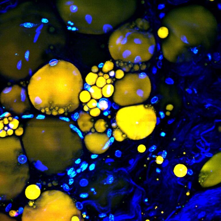 image3 fat cells in tissue1 768x768